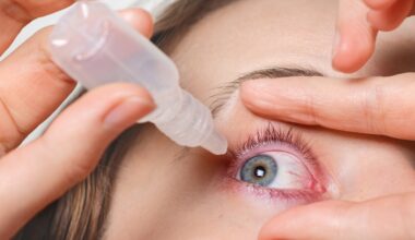 Dry Eye Symptoms