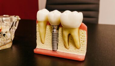 How Dental Implants Restore Confidence In Everyday Life
